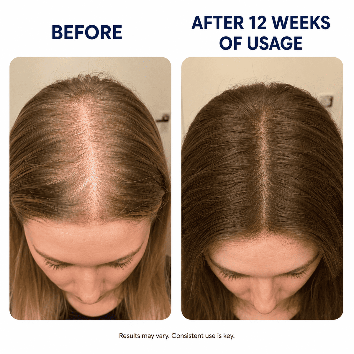 ReVolt™ PDRN + Caffeine Serum — Made for Thinning Hair
