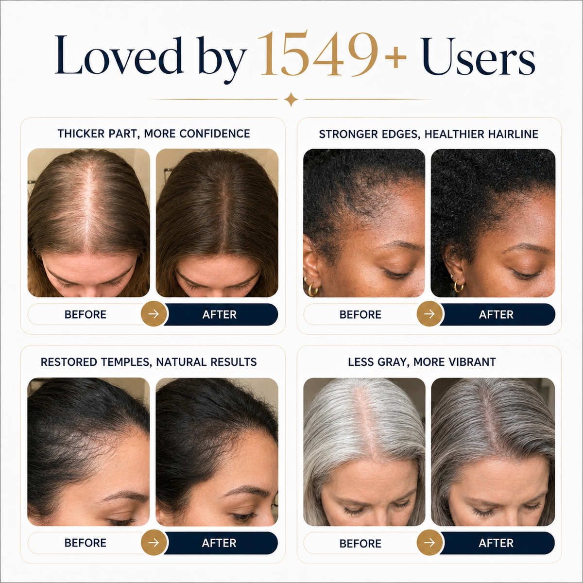 ReVolt™ PDRN + Caffeine Serum — Made for Thinning Hair