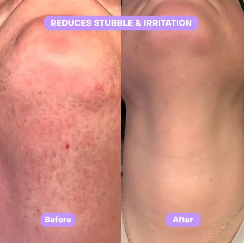 Before and after